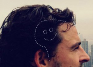 Chad Peacock in profile with a dotted line on the photo marking out a brain surgery scar. Inside the line is a smiley face.